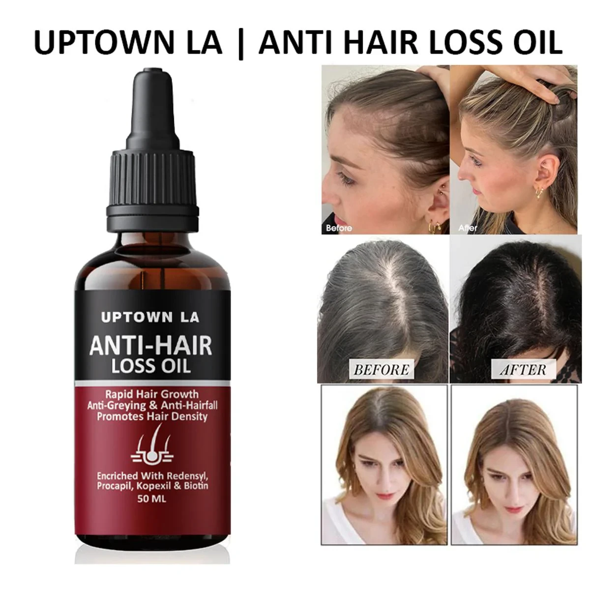 Uptown LA Anti Hair Loss Hair Regrowth Oil 30 Ml