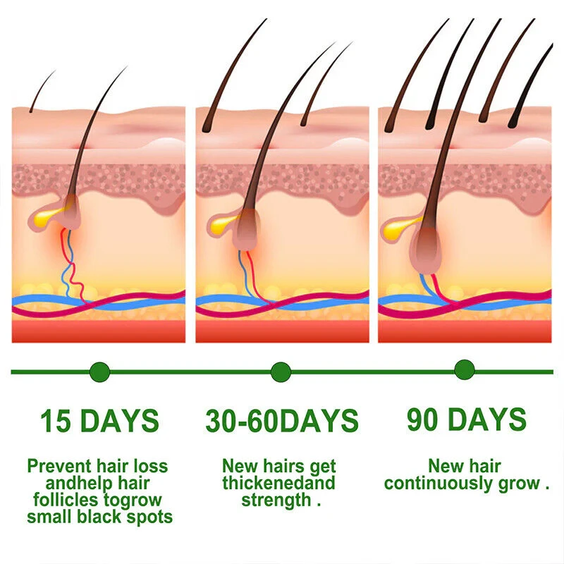 Uptown LA Anti Hair Loss Hair Regrowth Oil 30 Ml